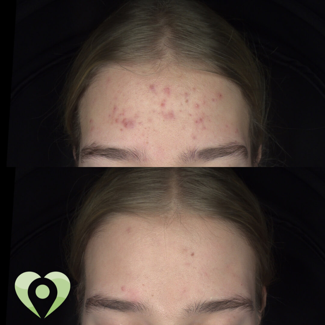 liposoompeeling (2)