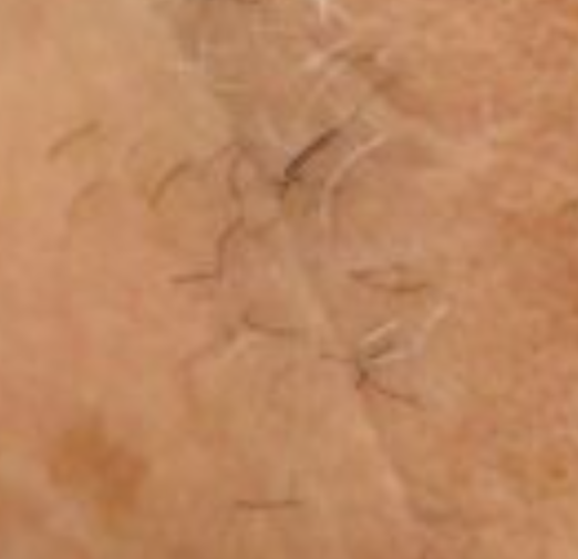 Haargroei_closeup